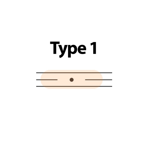 Type 1