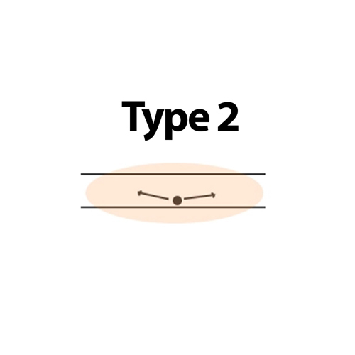 Type 2