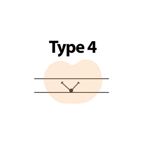 Type 4